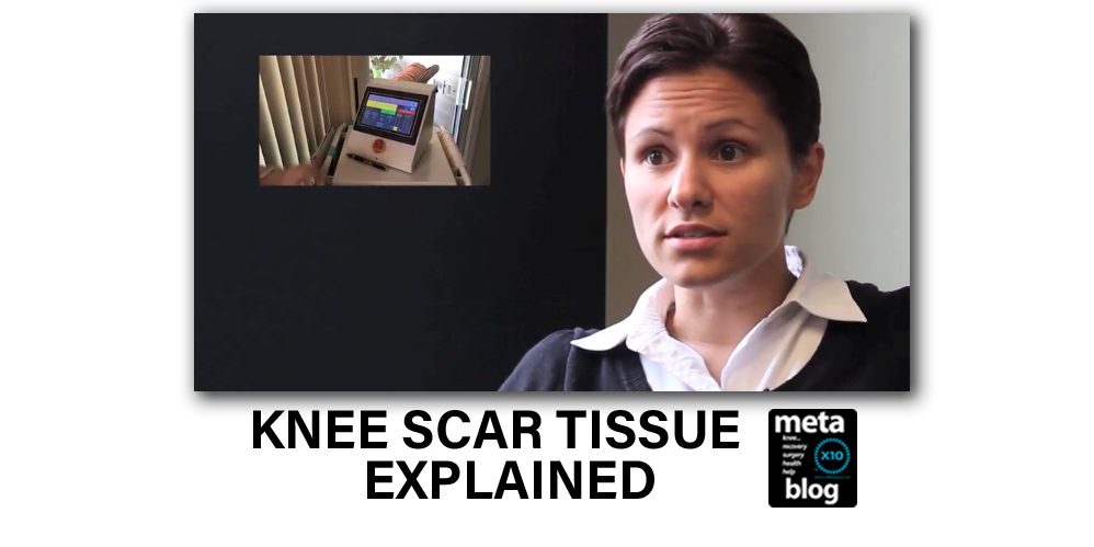 Lisa-Alarcon-Knee-Scar-Tissue-Explained