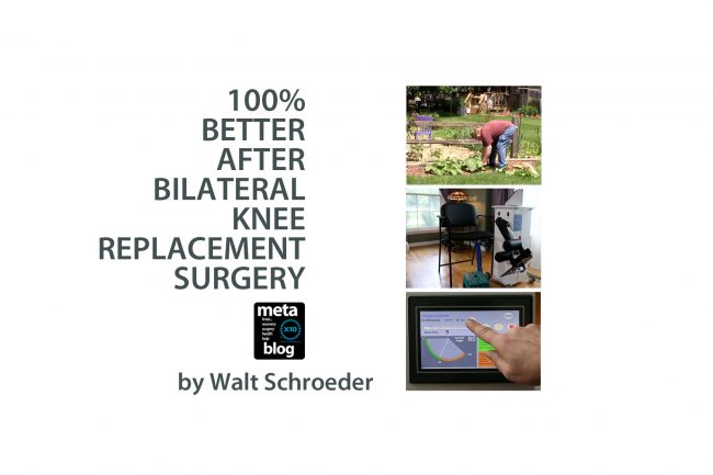 Better After Bilateral Knee Replacement Surgery Better After Bilateral Knee Replacement Surgery