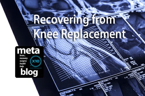 Recovering From Knee Replacement