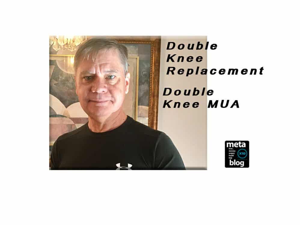 Double-Knee-Replacement-Double-MUA