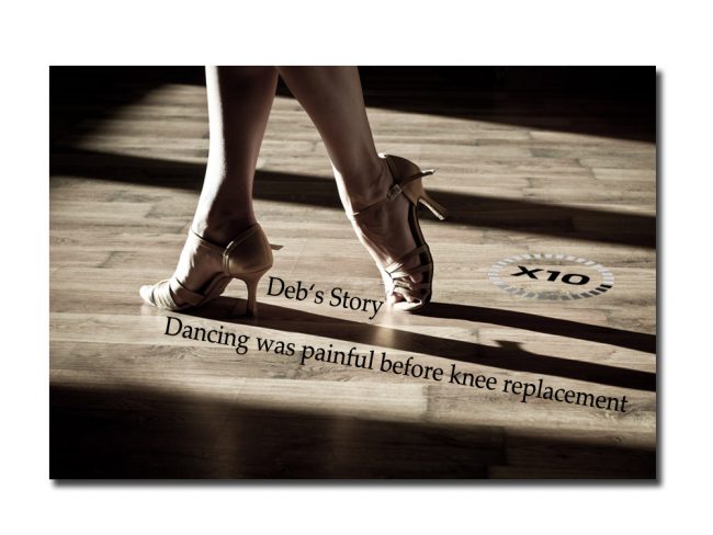Dancing After Knee Replacement Dancing After Knee Replacement