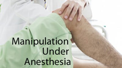 Knee Manipulation Under Anesthesia Recovery