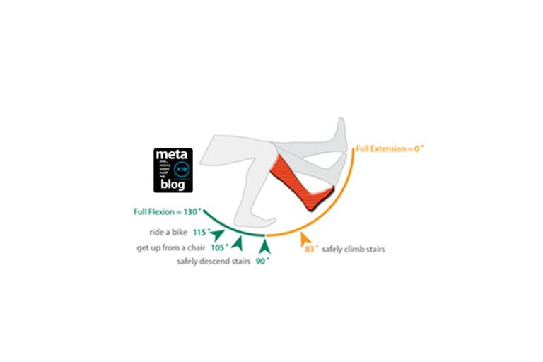 Six Weeks After Knee Replacement