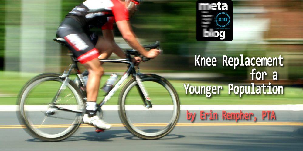 Knee Replacement for a Younger Population Knee Replacement for a Younger Population