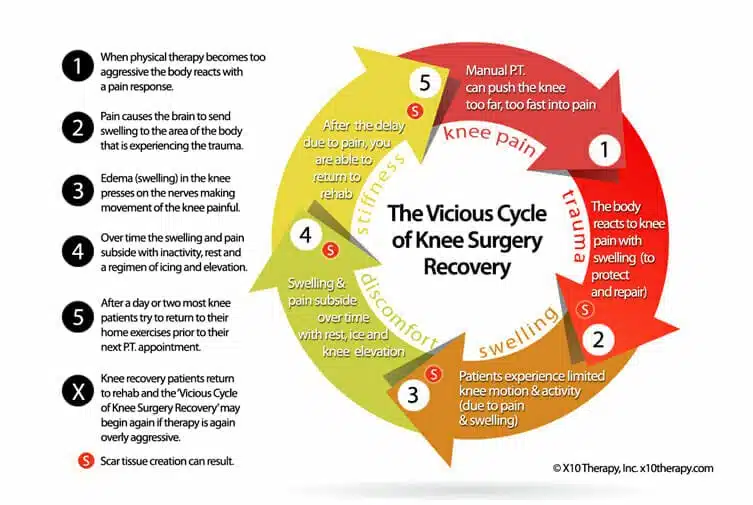 Understanding Swelling and Scar Tissue After Knee Replacement