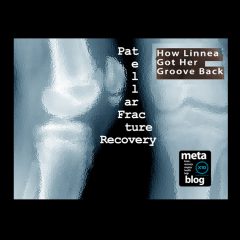 Patellar Fracture Recovery