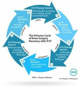How the X10 Works How the X10 Works