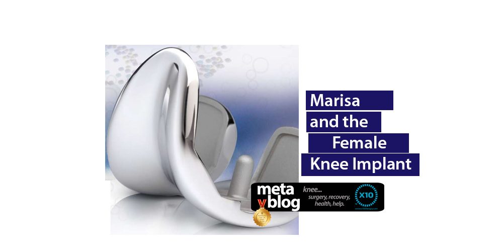 Female Knee Implant Female Knee Implant