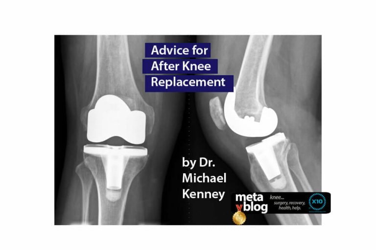 Advice After Knee Surgery Advice After Knee Surgery
