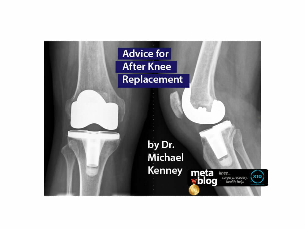 Advice After Knee Surgery Advice After Knee Surgery