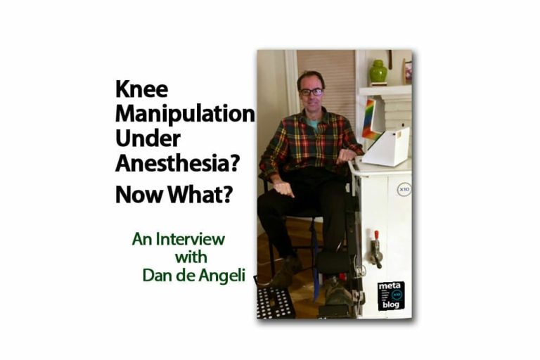 After Manipulation Under Anesthesia After Manipulation Under Anesthesia