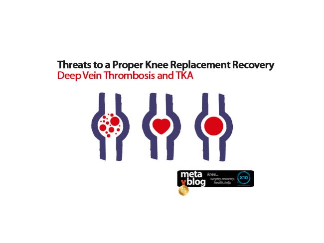 Deep Vein Thrombosis and TKA