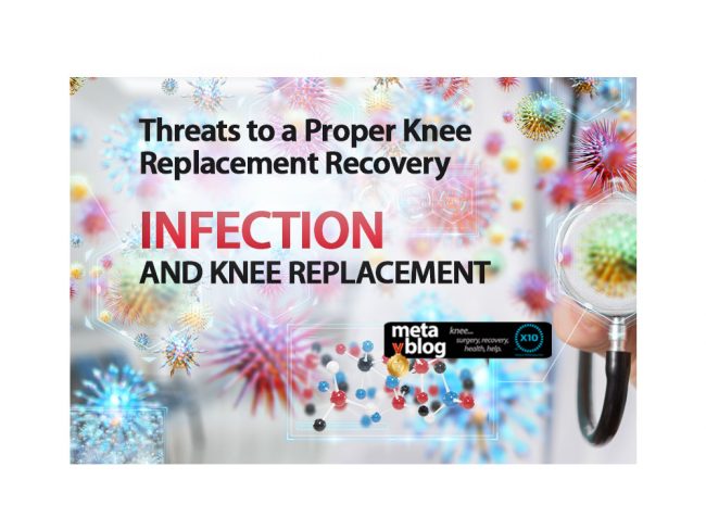 Infection and Knee Replacement
