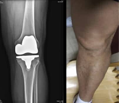 Online Knee Assessment Tools for 2019