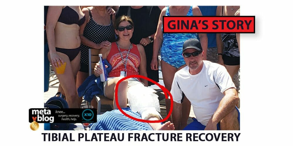 Tibial Plateau Fracture Recovery