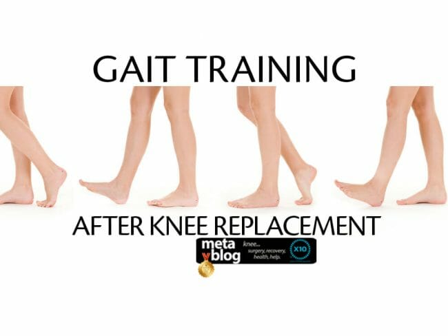 Gait Training After Knee Replacement Gait Training After Knee Replacement