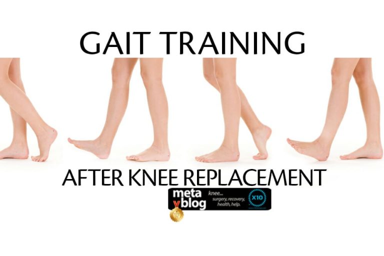 Gait Training After Knee Replacement Gait Training After Knee Replacement