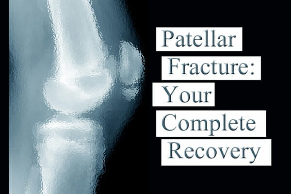 Patellar Fracture on Facebook