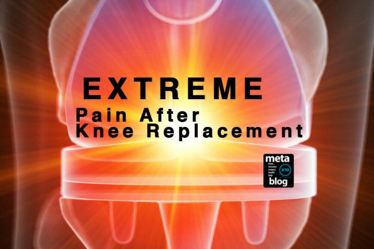 Extreme Pain After Total Knee Replacement