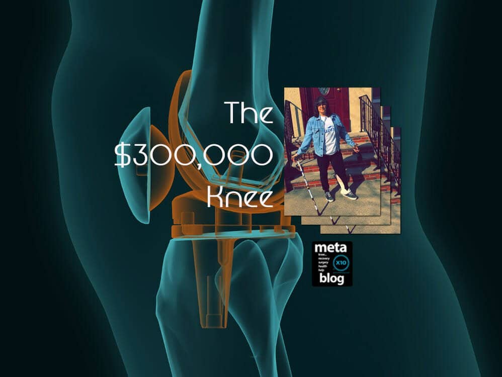 The-$300,000-Knee (Lois' Knee Recovery Nightmare)