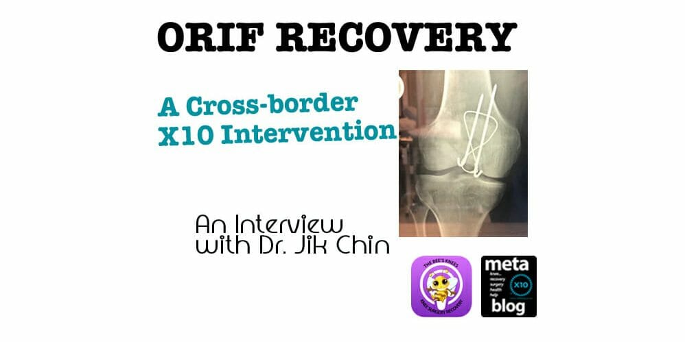 ORIF Knee Recovery ORIF Knee Recovery