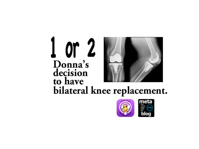 Deciding-on-Bilateral-Knee-Replacement Deciding-on-Bilateral-Knee-Replacement