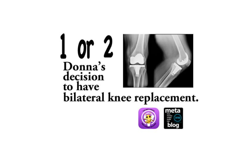 Deciding-on-Bilateral-Knee-Replacement
