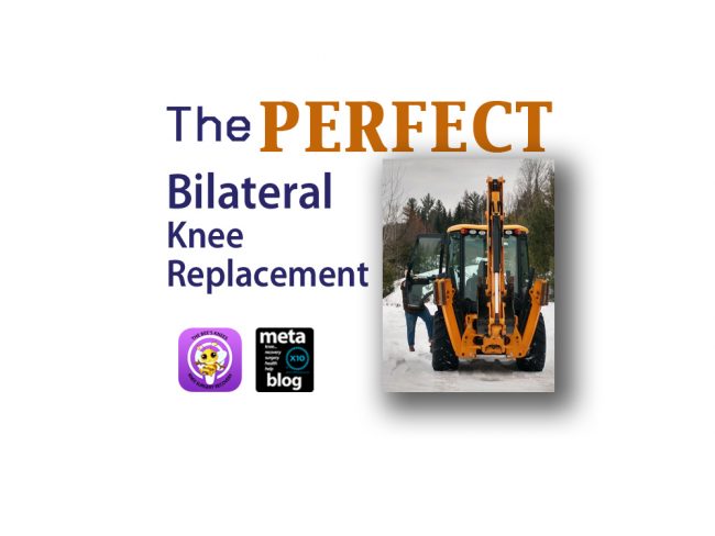 The-Perfect-Bilateral-Knee-Replacement-Larry-Meservey