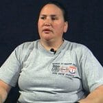 After MUA Manipulation Under Anesthesia