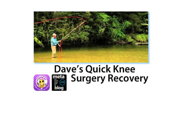 Quick-Knee-Surgery-Recovery