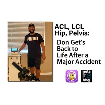 ACL-LCL-Knee-Recovery