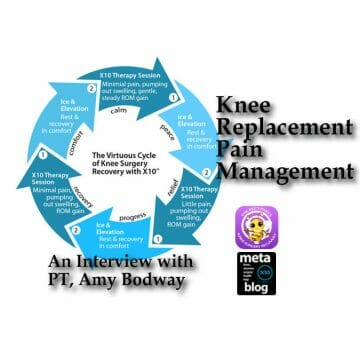 Knee-Replacement-Pain-Management-Signature-Image