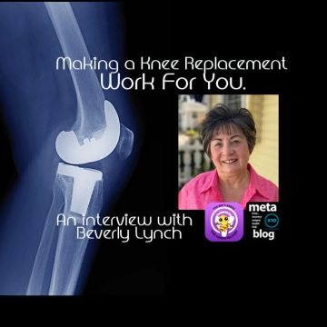 Making a Knee Replacement Work For You