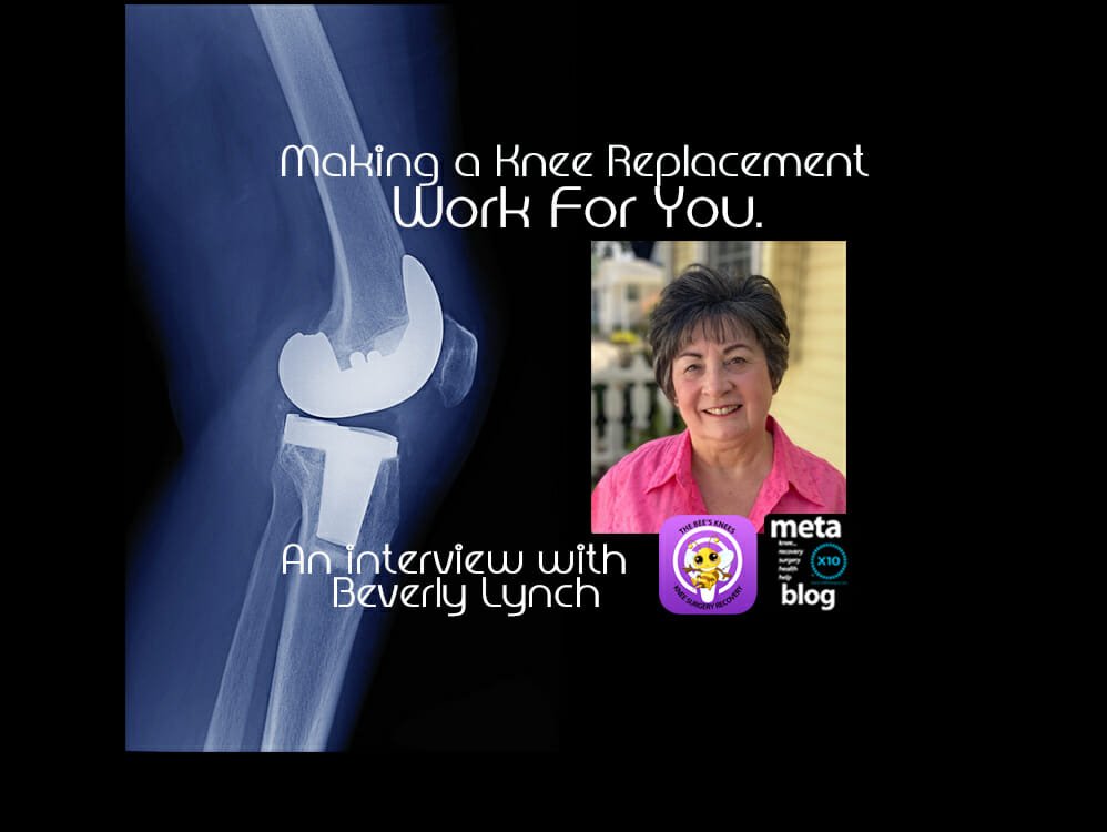 Making a Knee Replacement Work For You