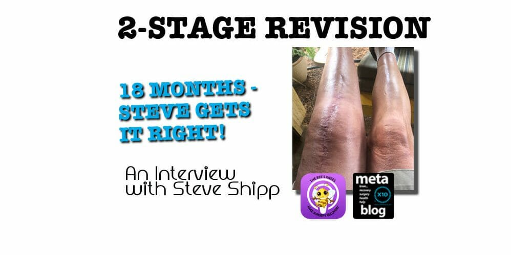 Two Stage Knee Revision