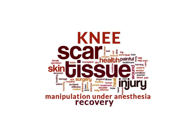 Knee Replacement and then rapid scar tissue