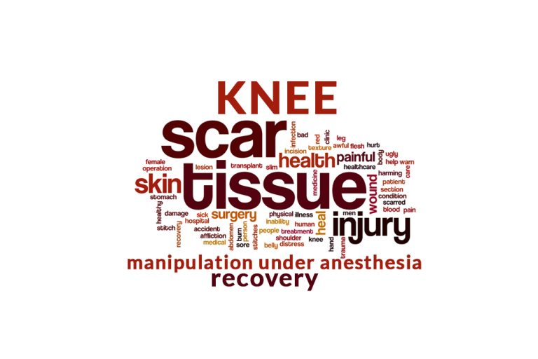 Knee Replacement and then rapid scar tissue