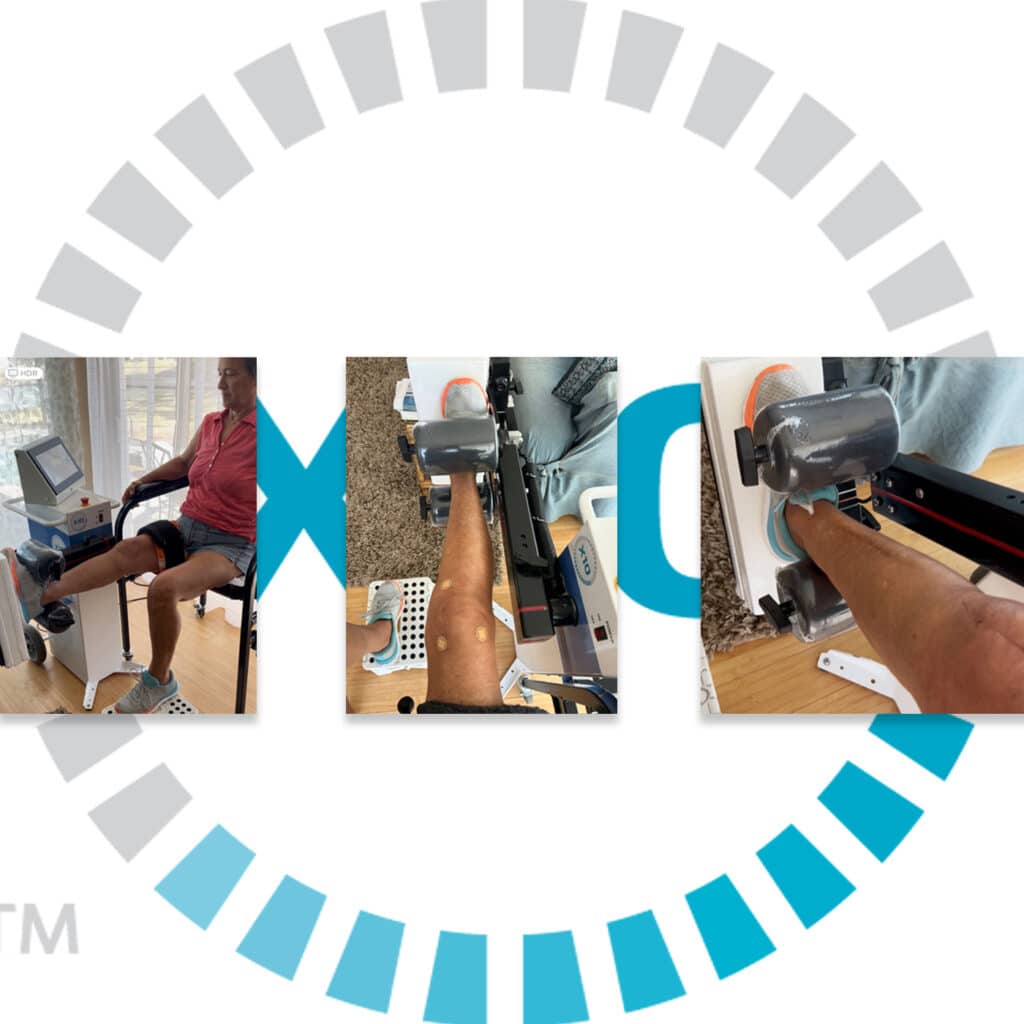 EPISODE-WOMEN-AND-KNEE-REPLACEMENT EPISODE-WOMEN-AND-KNEE-REPLACEMENT