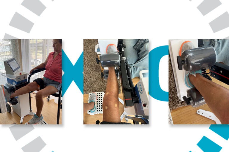 FEATURE-WOMEN-AND-KNEE-REPLACEMENT-RECOVERY